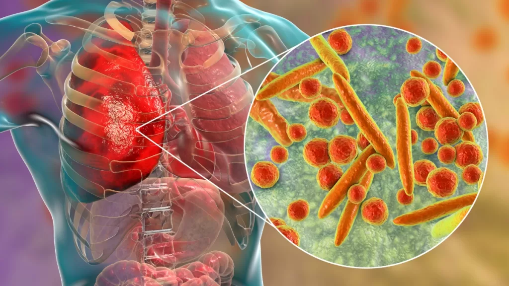 Alerta Por Mycoplasma Esta Es La Medida Que Se Tomaría Sobre Las Vacaciones De Verano Ante Aumento De Contagios (1)